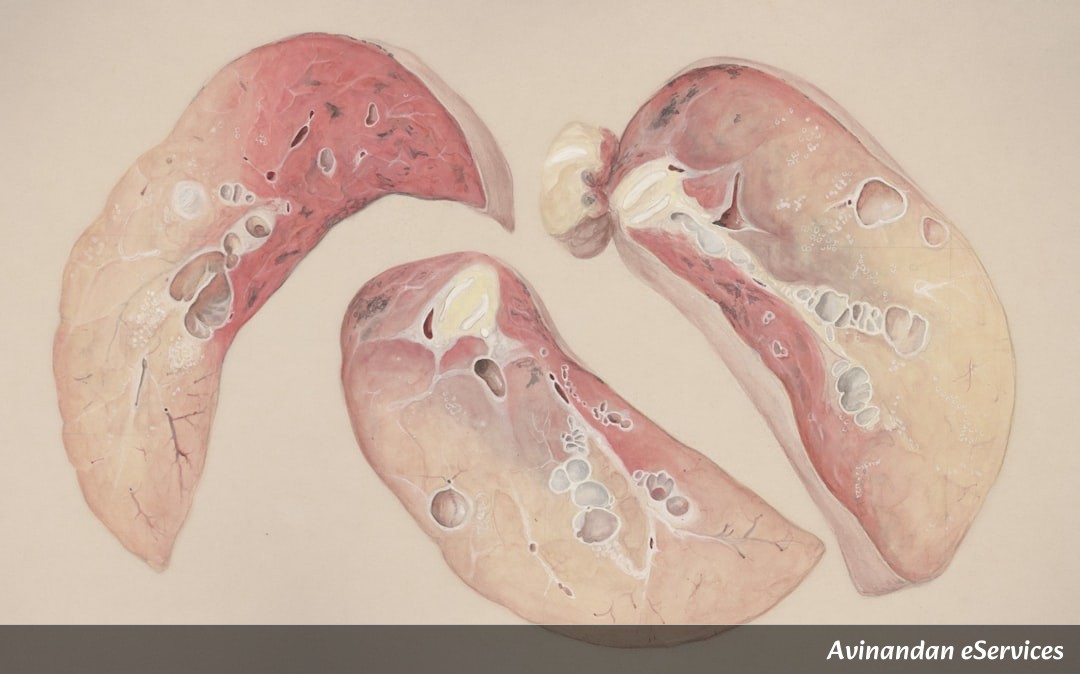 RRB NTPC & Group D Biology: Master the Human Respiratory System – Organs, Mechanism & Solved Questions