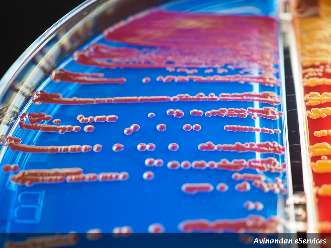 Why Do Some Bacteria 'Mine' Gold for Themselves?: A Science Chat with Aarav and Saanvi